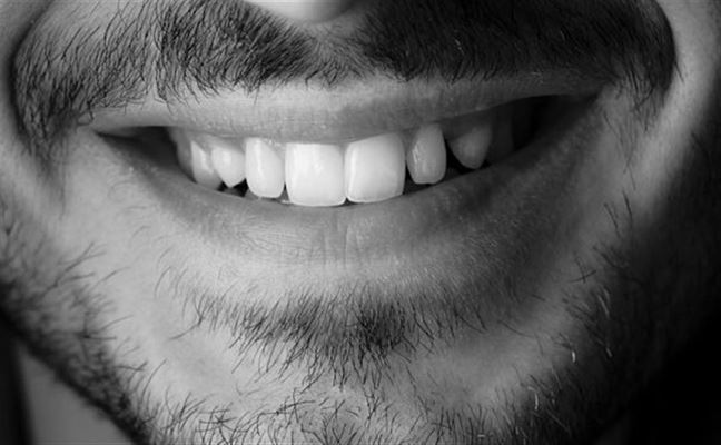 Smil med selvtillid vejen til et flot smil med tandretning