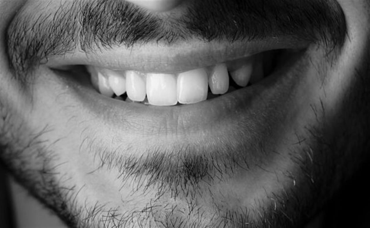 Smil med selvtillid vejen til et flot smil med tandretning